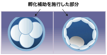 孵化補助を施工した部分