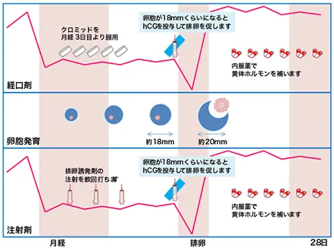 投薬をプラスしたタイミング療法