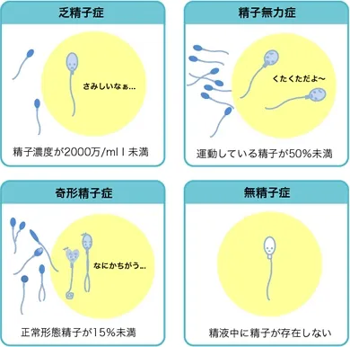 造精機能障害の例。乏精子症、精子無力症、奇形精子症、無精子症など
