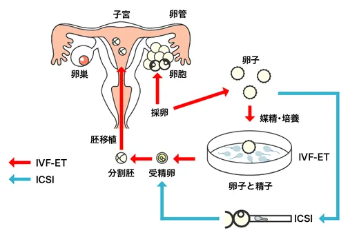 高度不妊治療(ART)のイメージ図