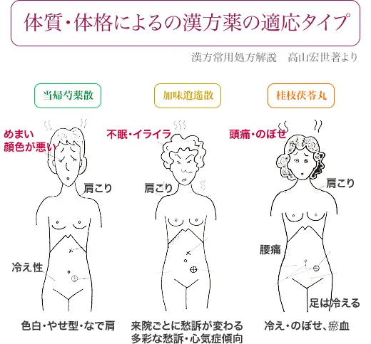体質・体格による漢方薬の適応タイプ
