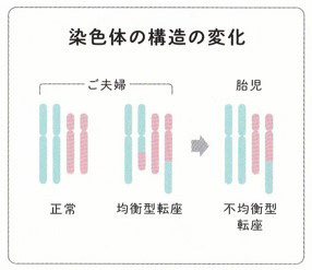 染色体の構造の変化